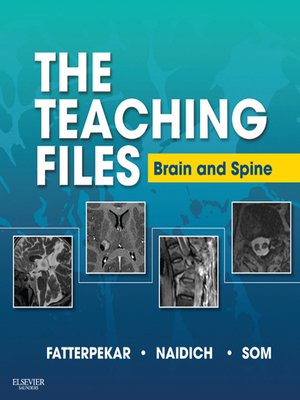 cover image of The Teaching Files